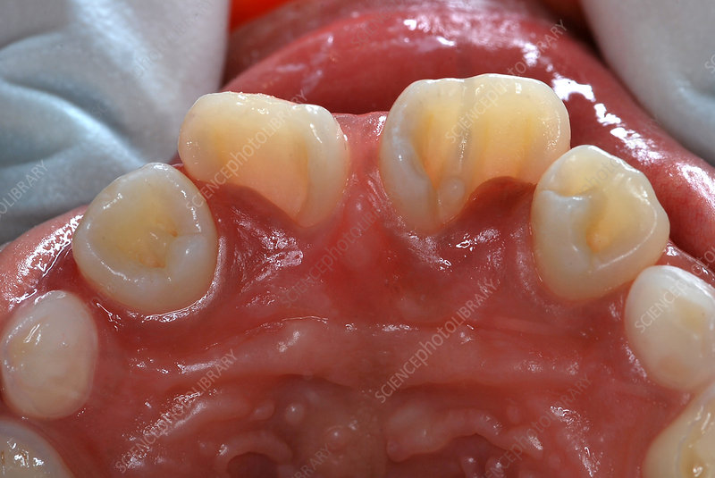 The 12 Strangest Dental Cases and Dental Oddities In History